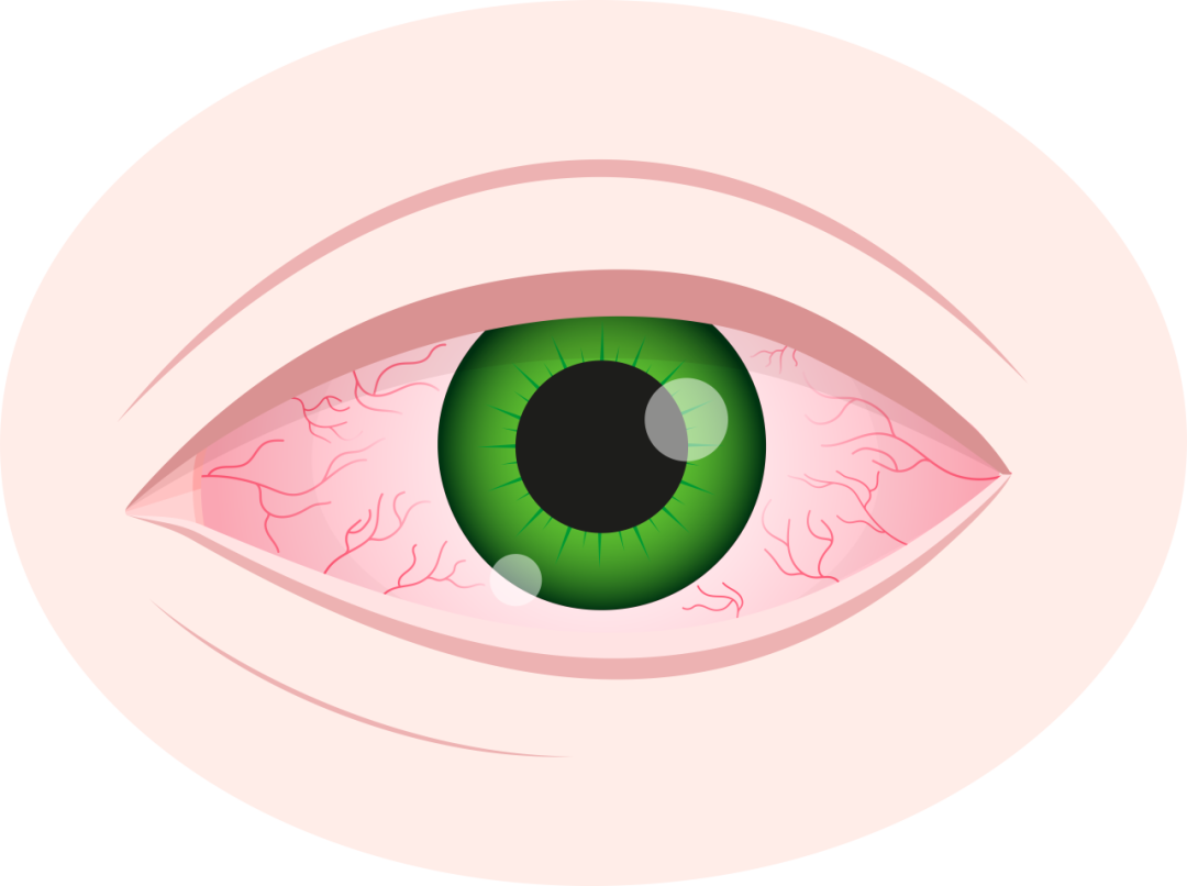 pixabay