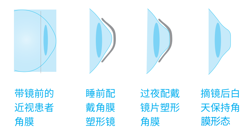 戴镜