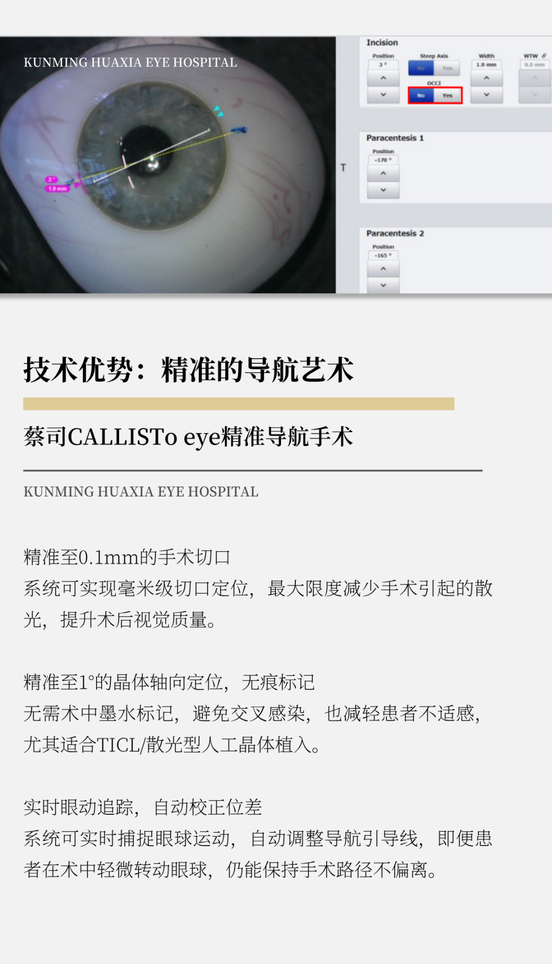 蔡司3
