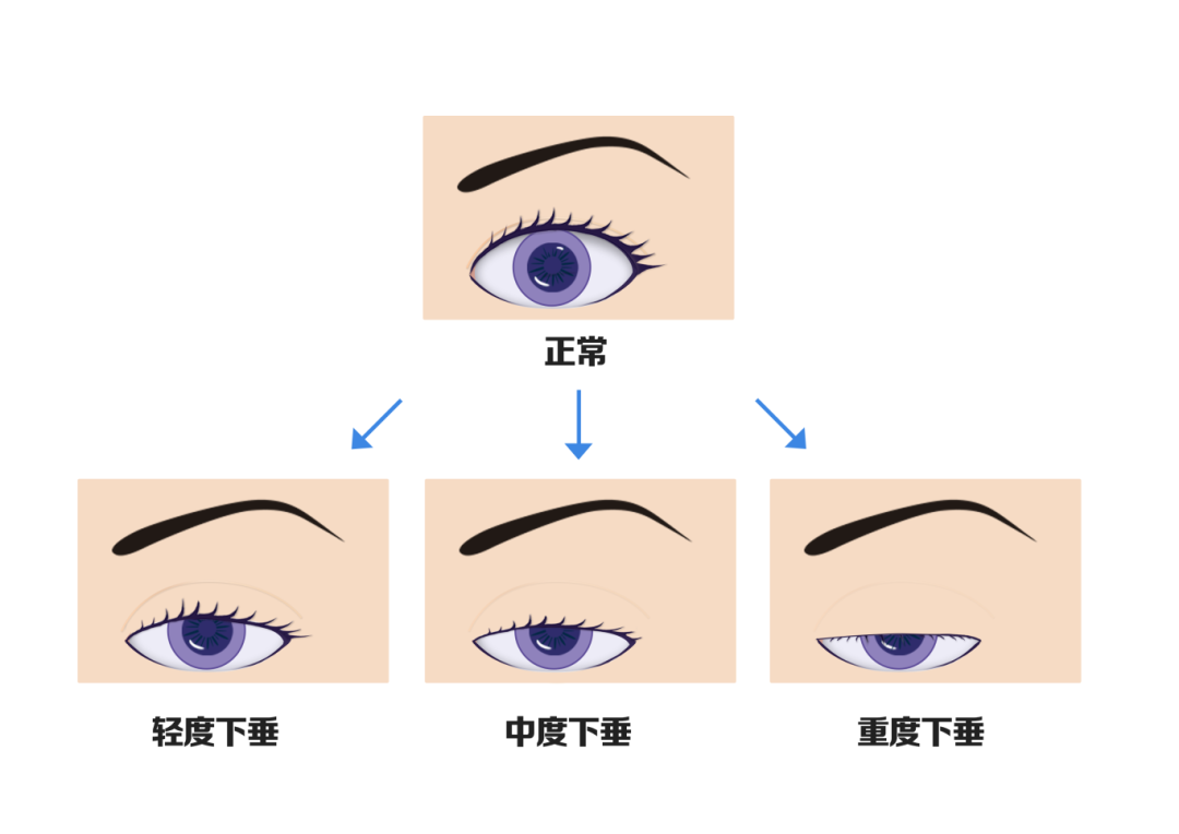 手术