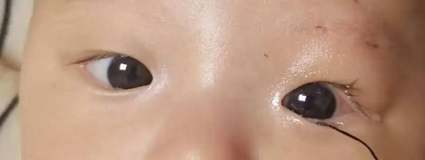 手术后