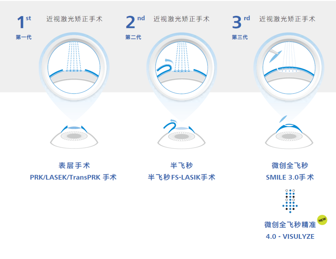精准4.0 VS全飞秒3.0