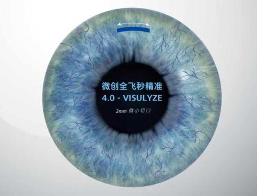 蔡司微创全飞秒精准 4.0-VISULYZE