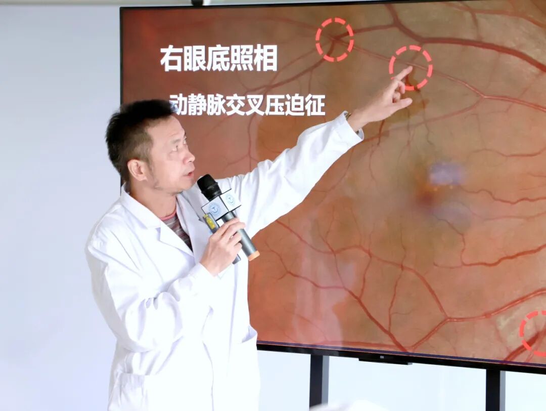 “控制眼压是一场持久战”