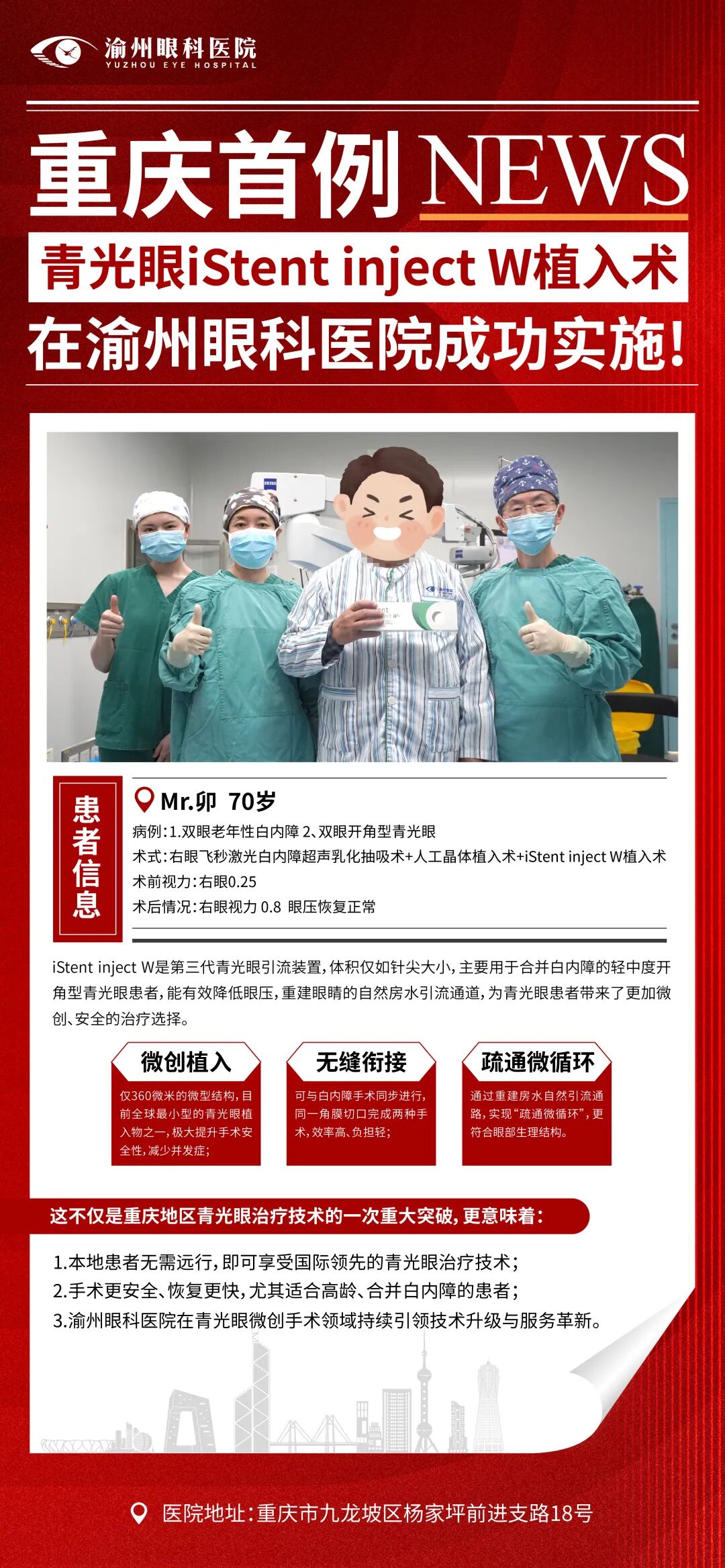 青光眼iStent inject W植入术在渝州眼科医院成功实施