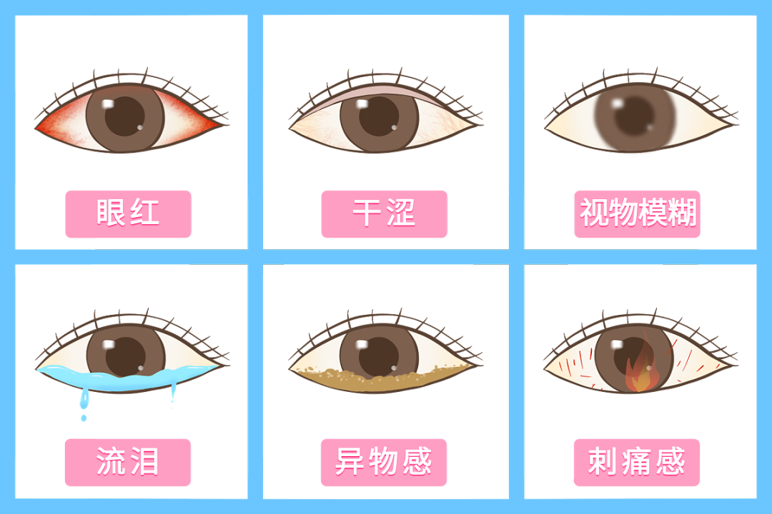 眼疲劳症状