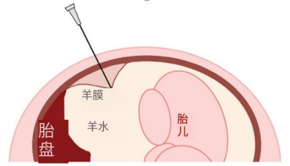 羊膜是单层上皮细胞互相连接构成的一层半透明薄膜