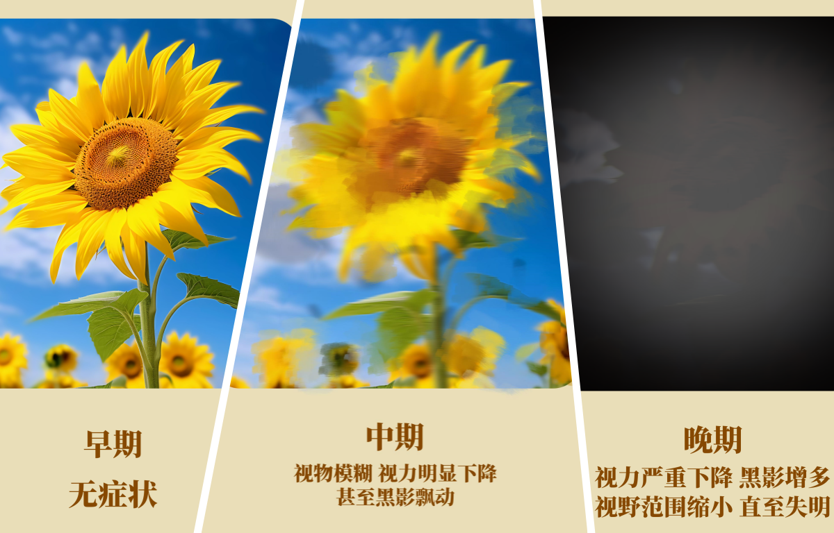 糖尿病视网膜病变症状