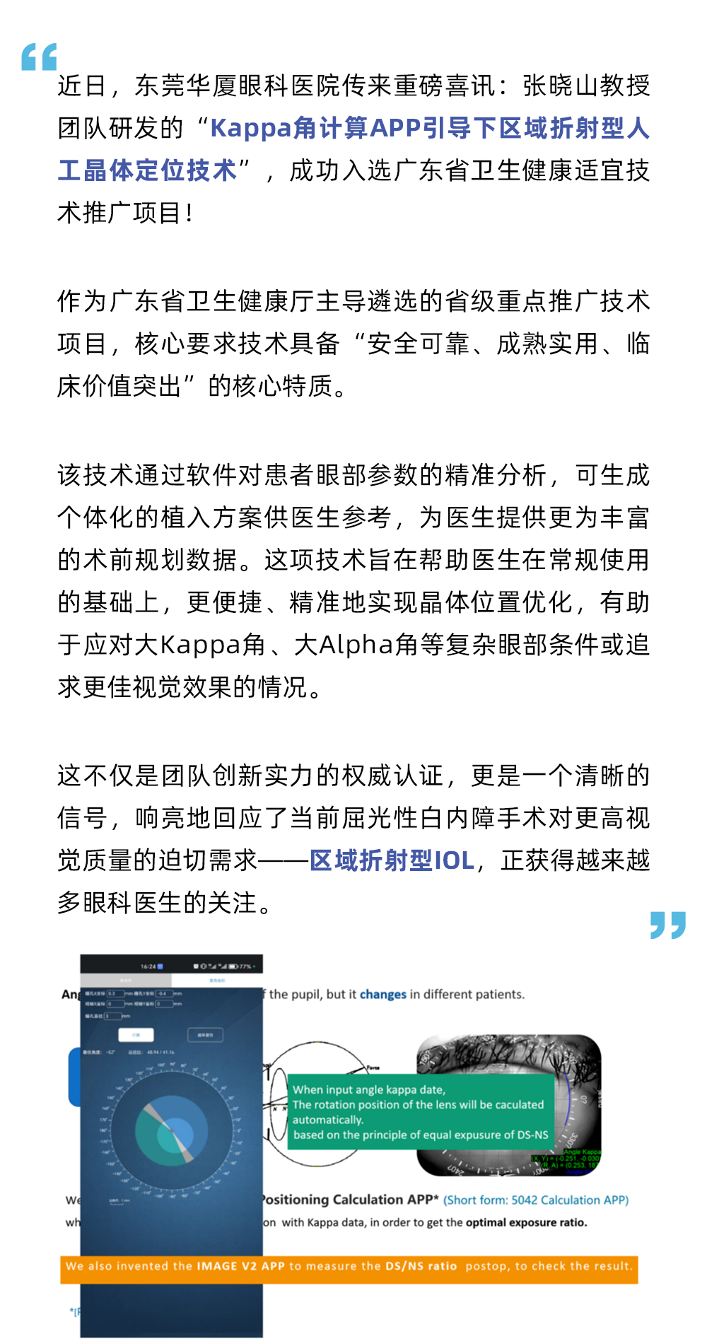 Kappa角计算APP引导人工晶体定位技术